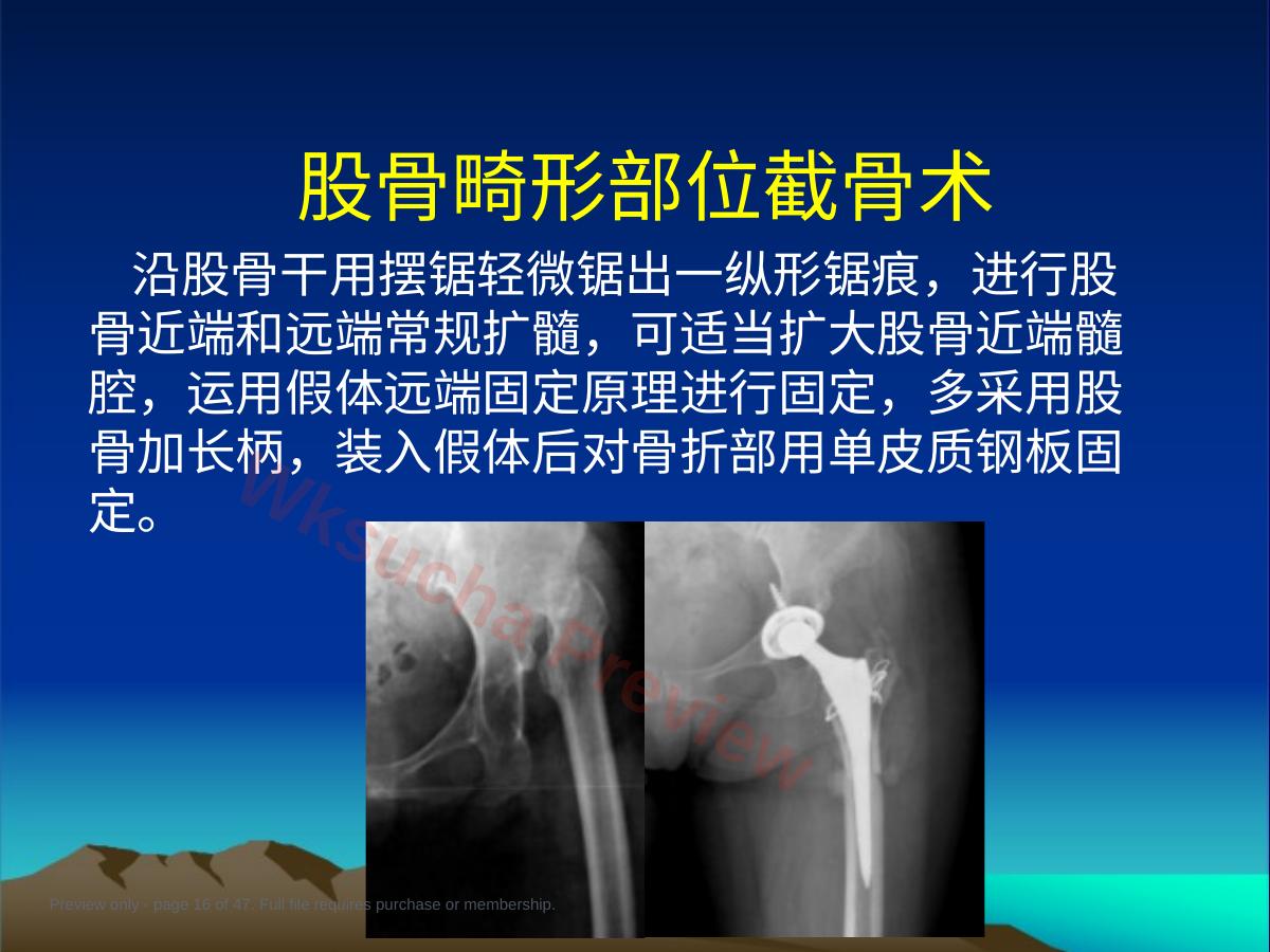 预览第 16 页