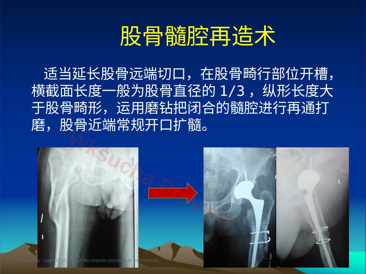 预览第 17 页