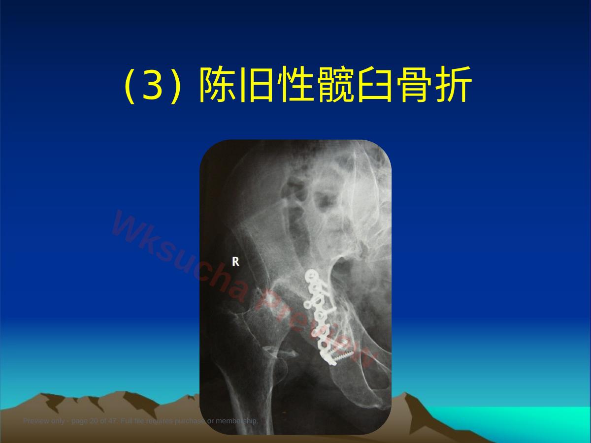 预览第 20 页