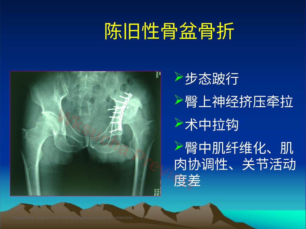 预览第 22 页