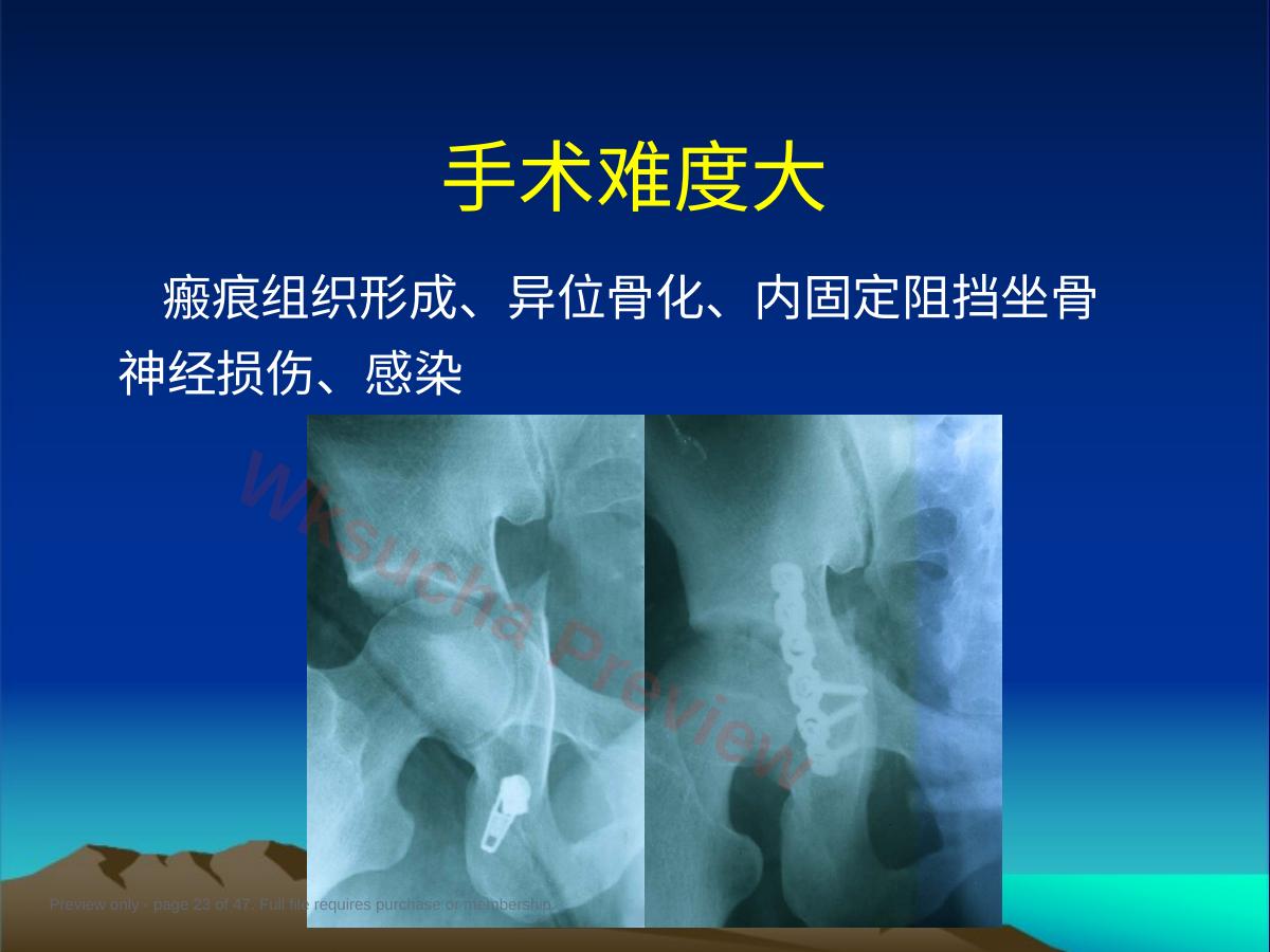 预览第 23 页