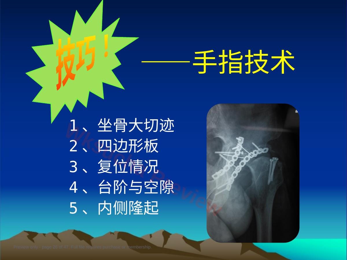 预览第 26 页