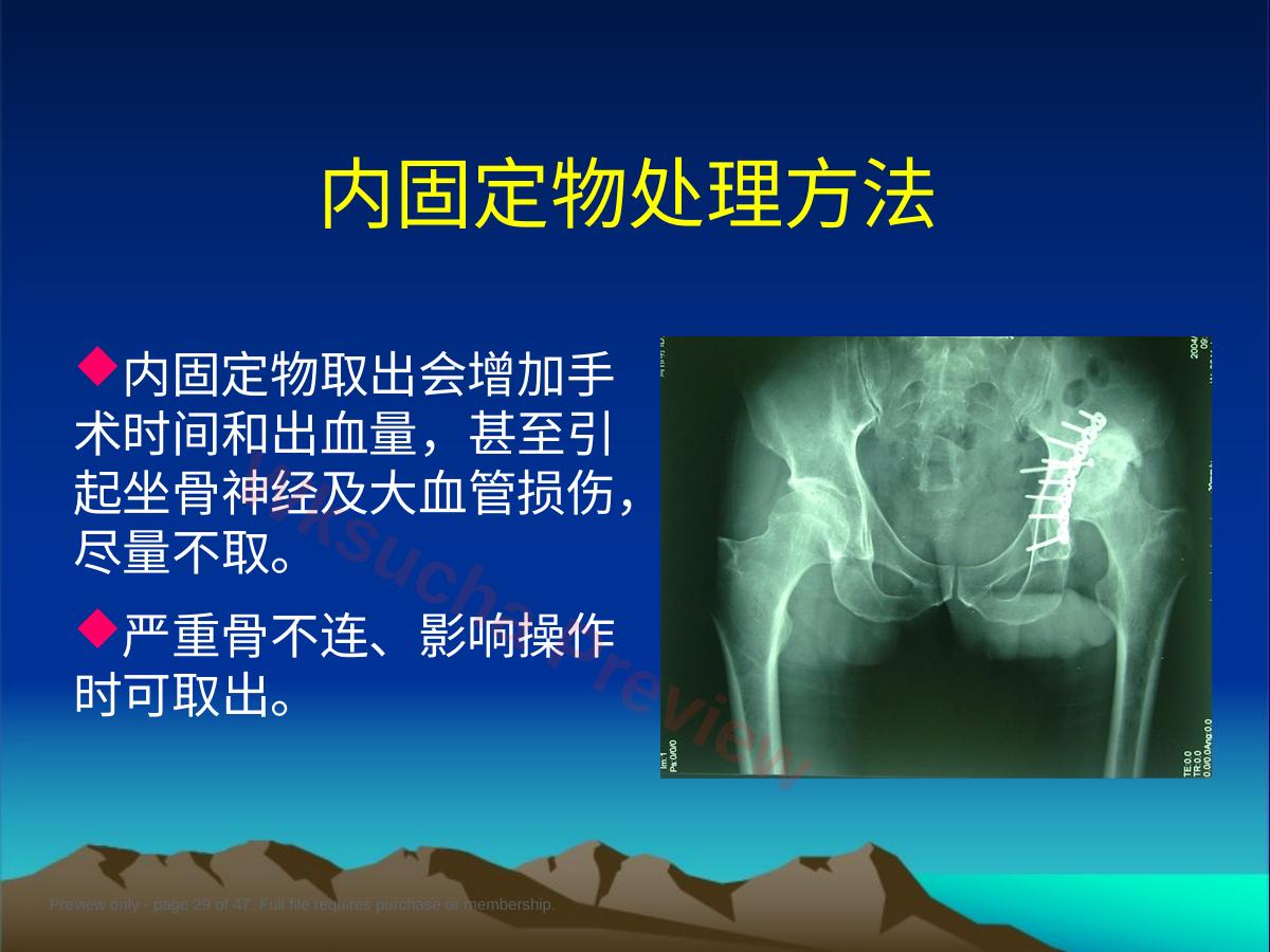 预览第 29 页
