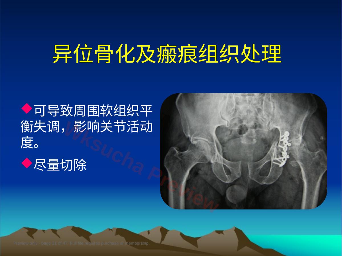 预览第 31 页