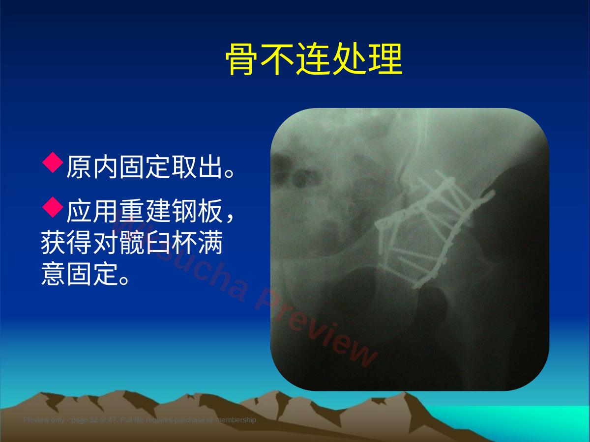 预览第 32 页