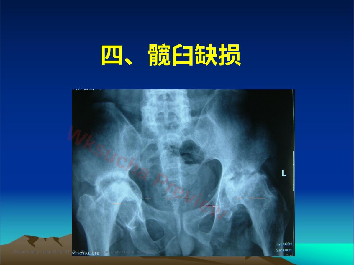 预览第 33 页