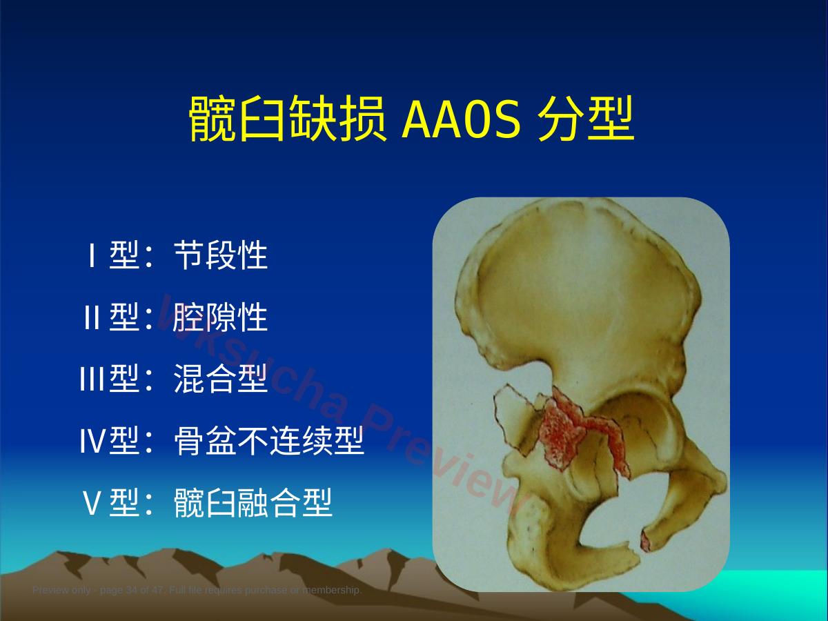 预览第 34 页
