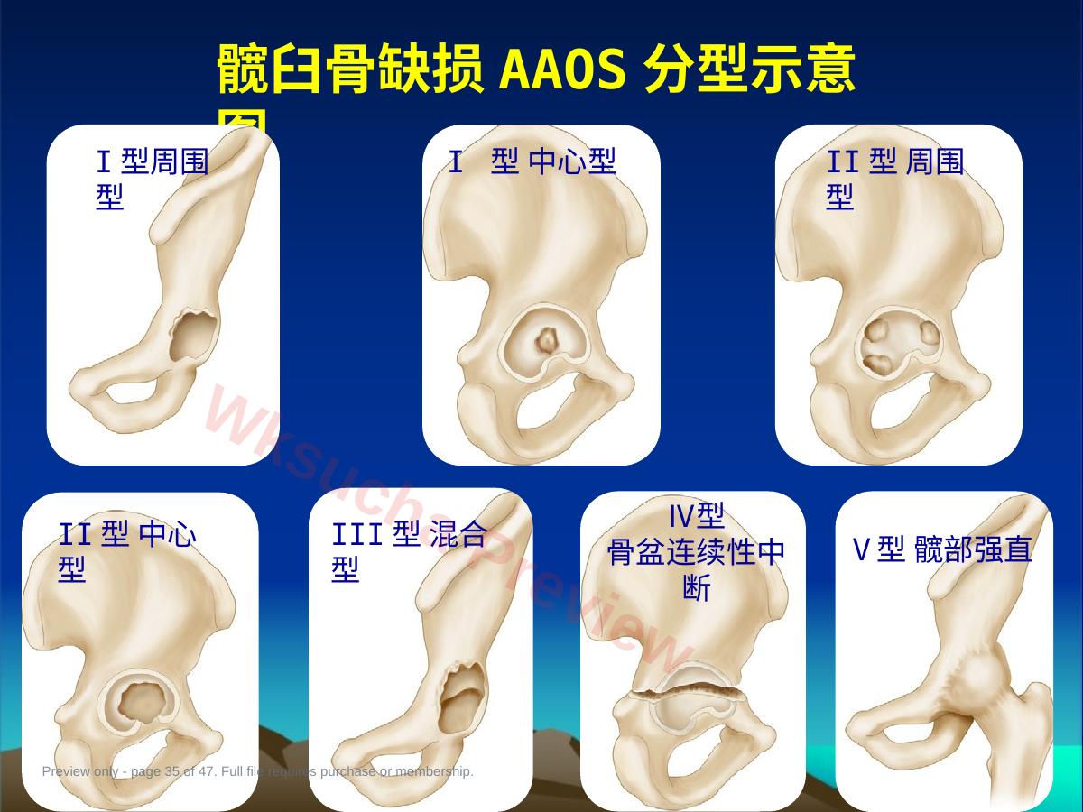 预览第 35 页