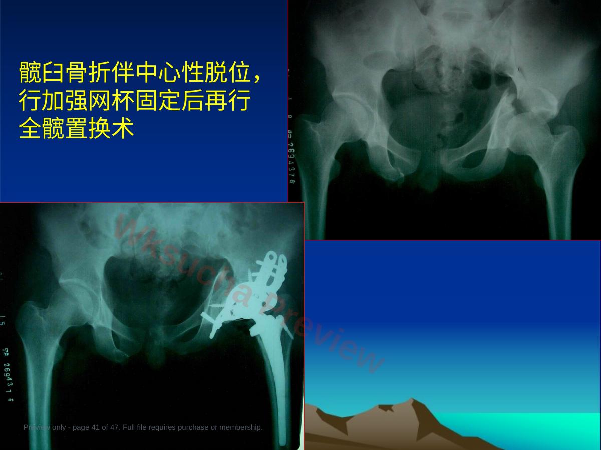 预览第 41 页