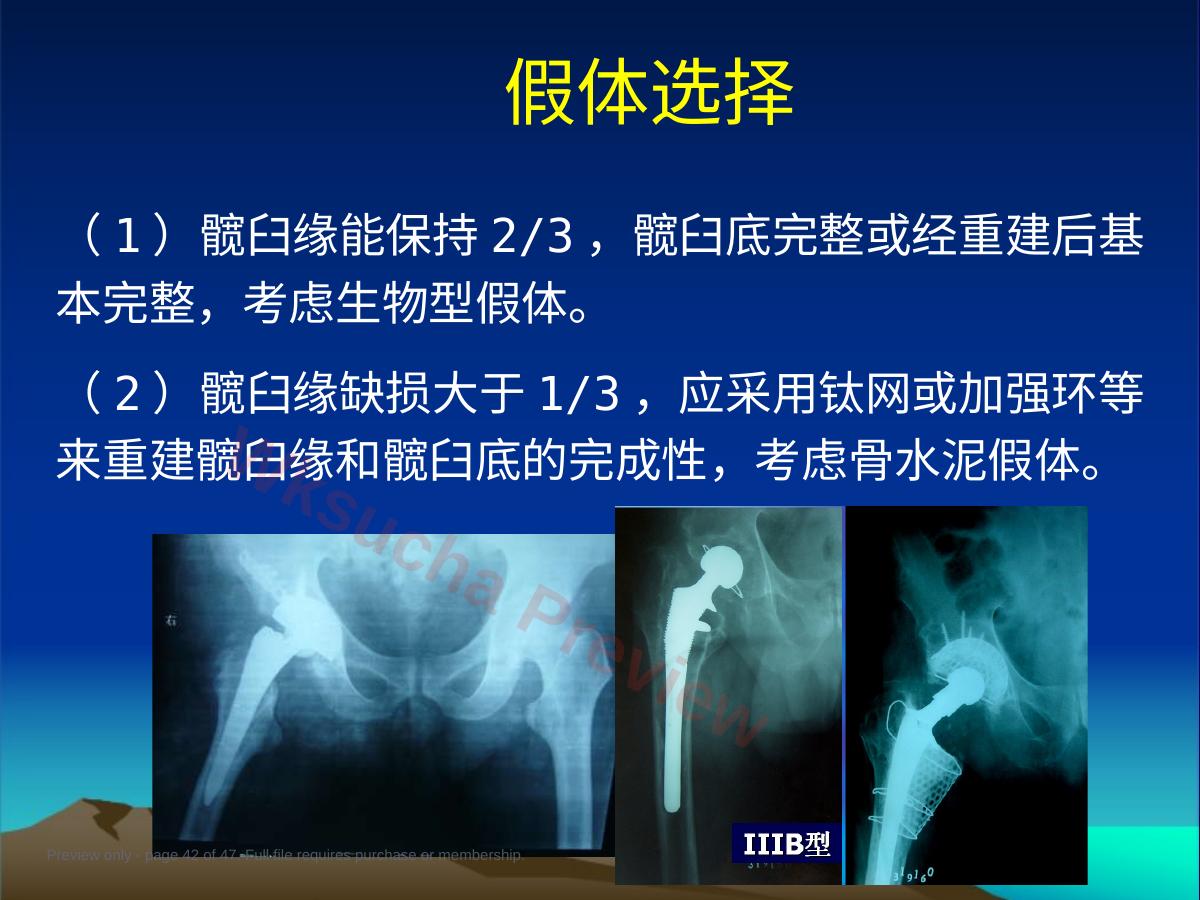 预览第 42 页