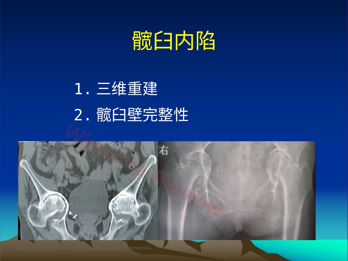预览第 43 页