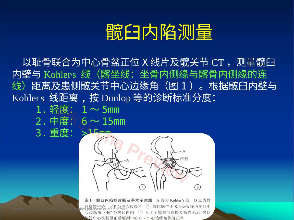 预览第 45 页