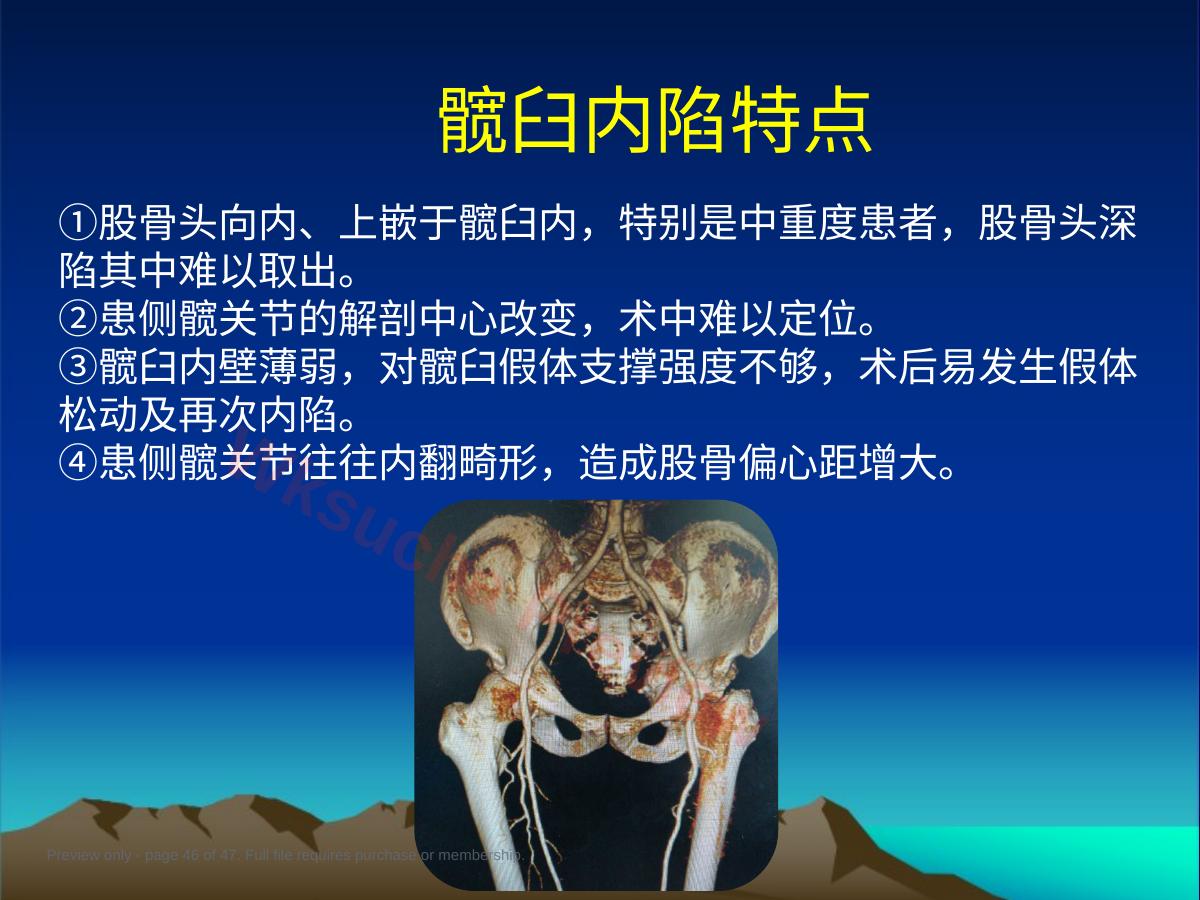 预览第 46 页
