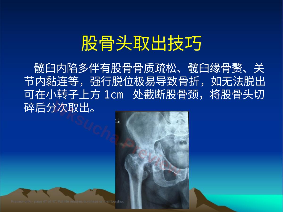 预览第 47 页
