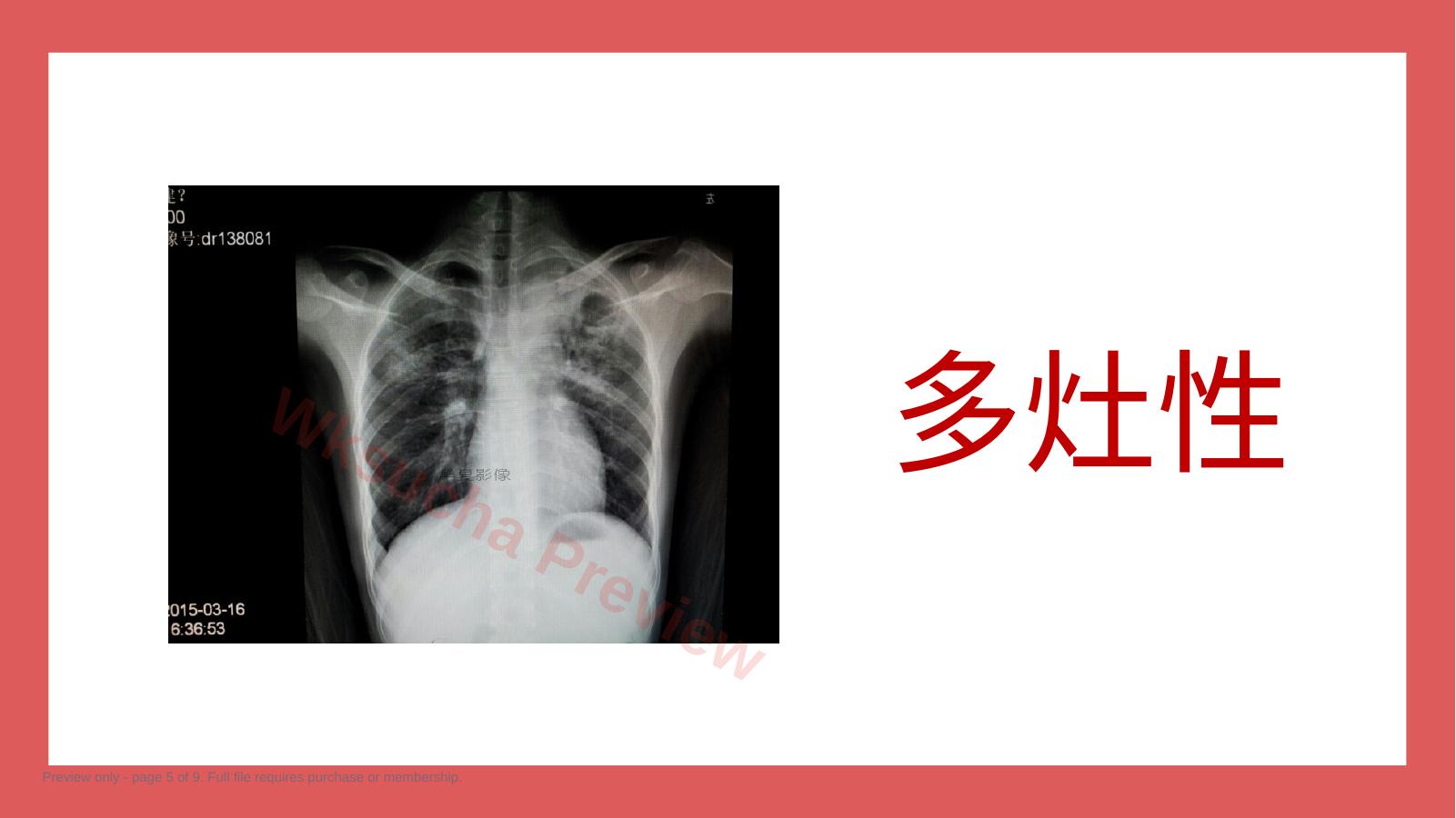 预览第 5 页