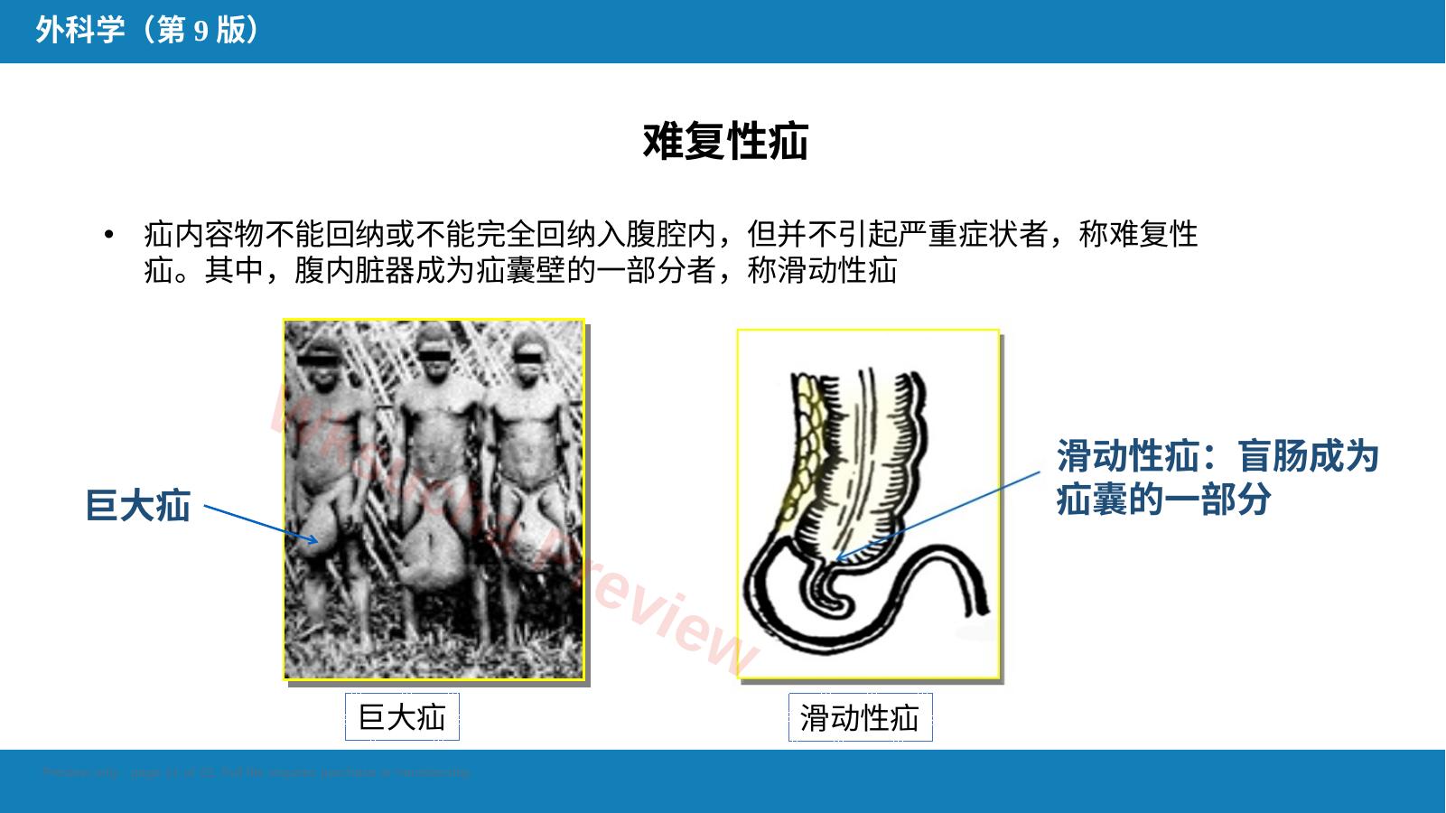 预览第 11 页