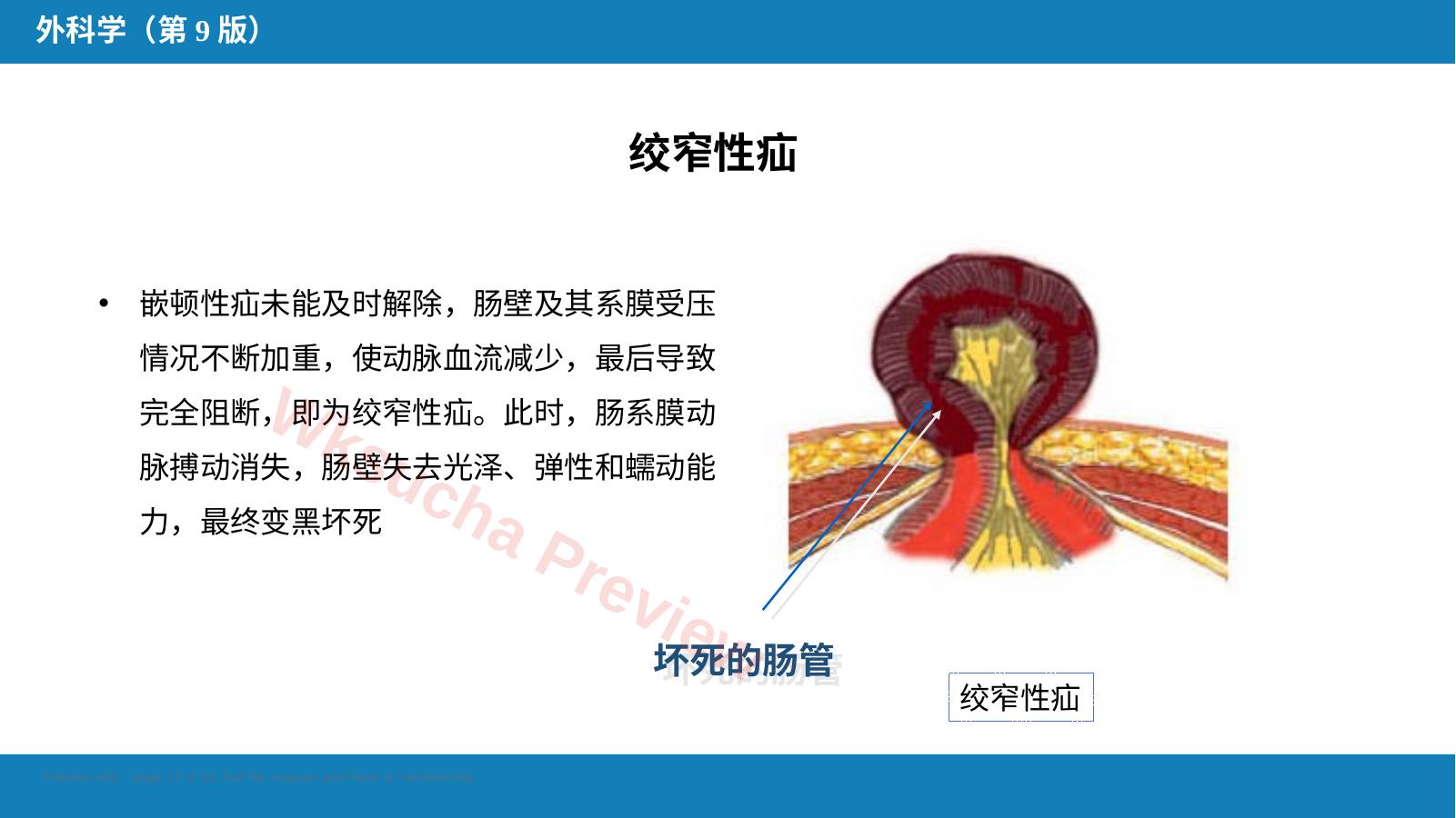 预览第 13 页