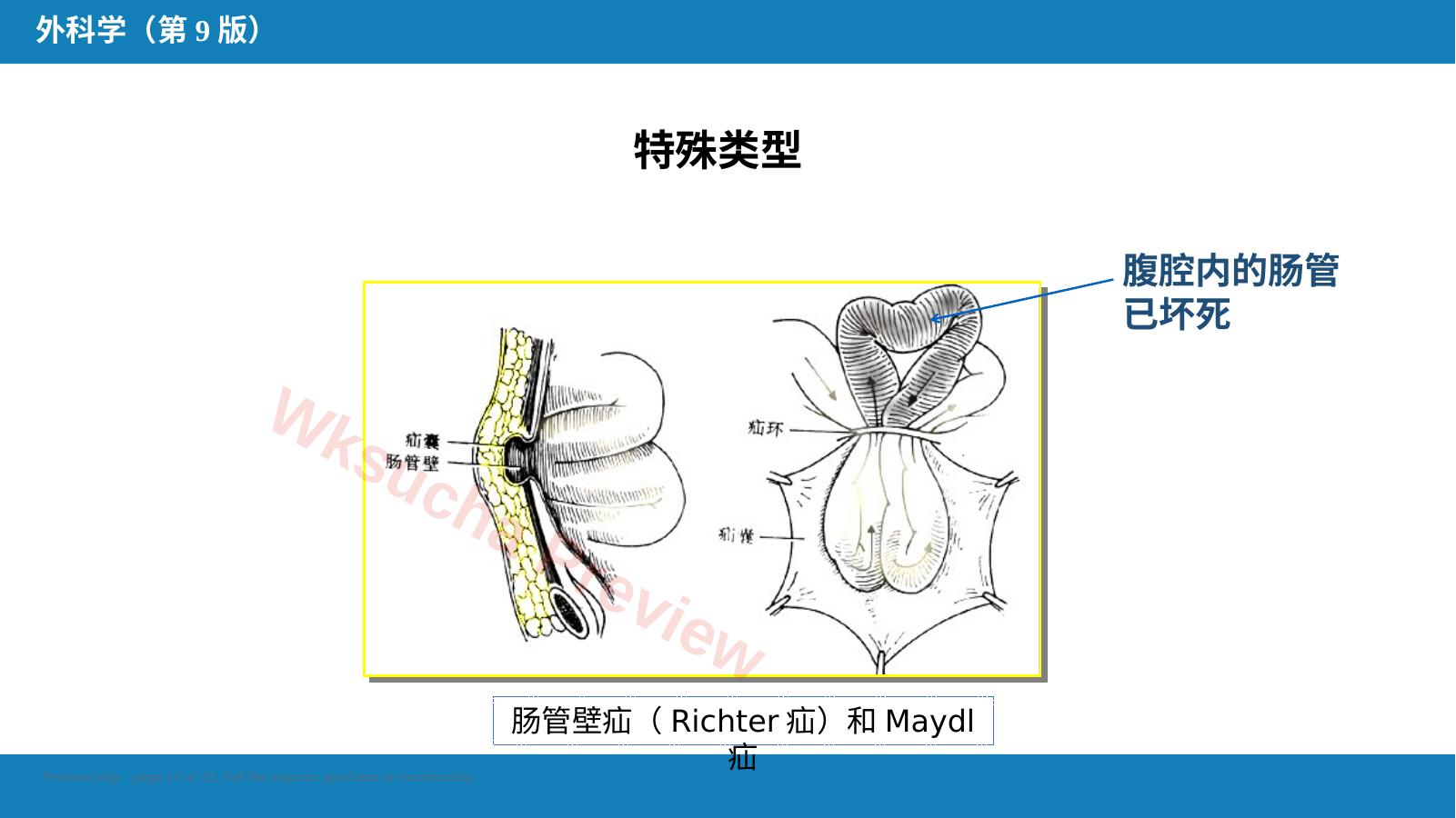预览第 14 页