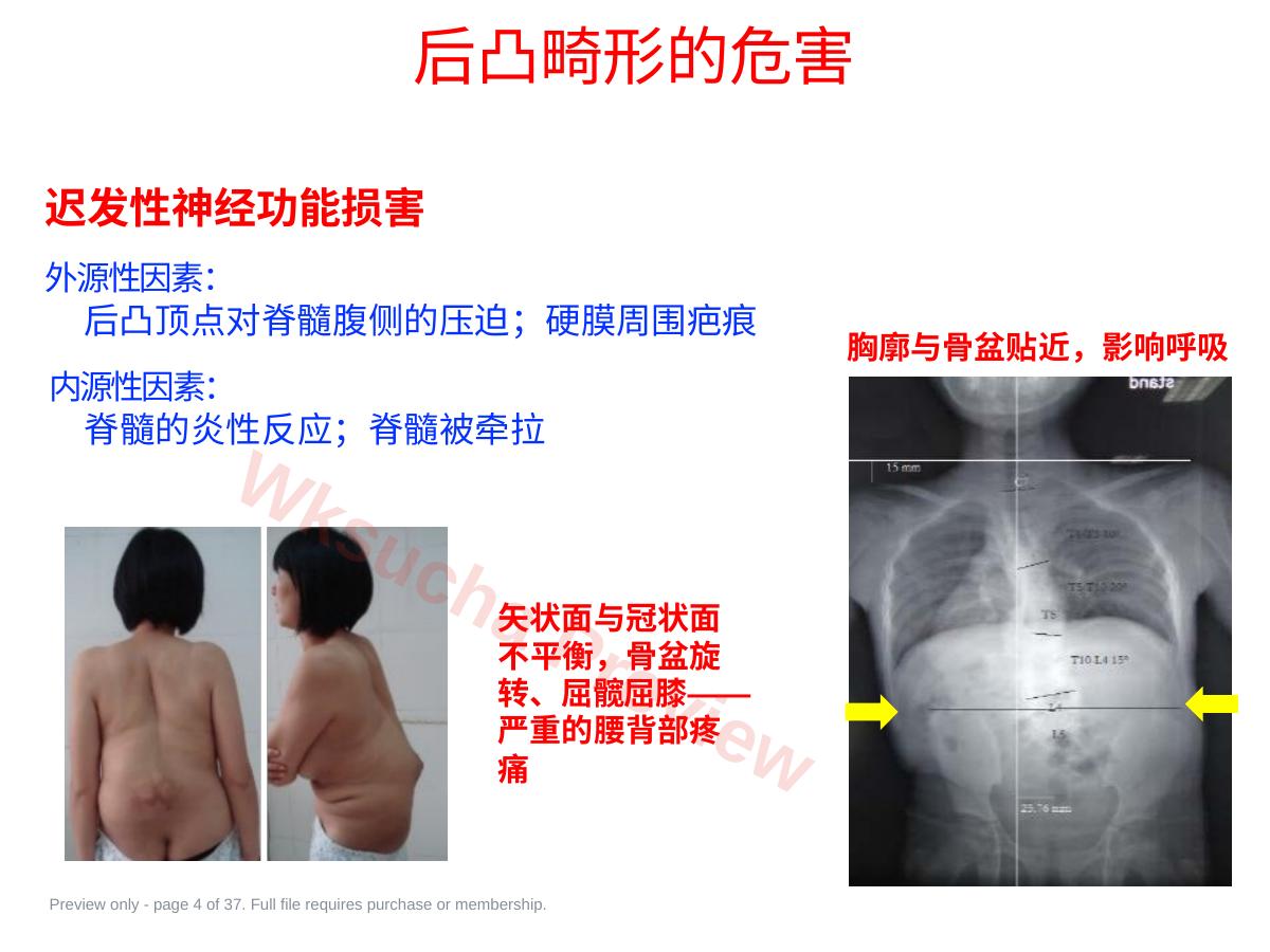 预览第 4 页