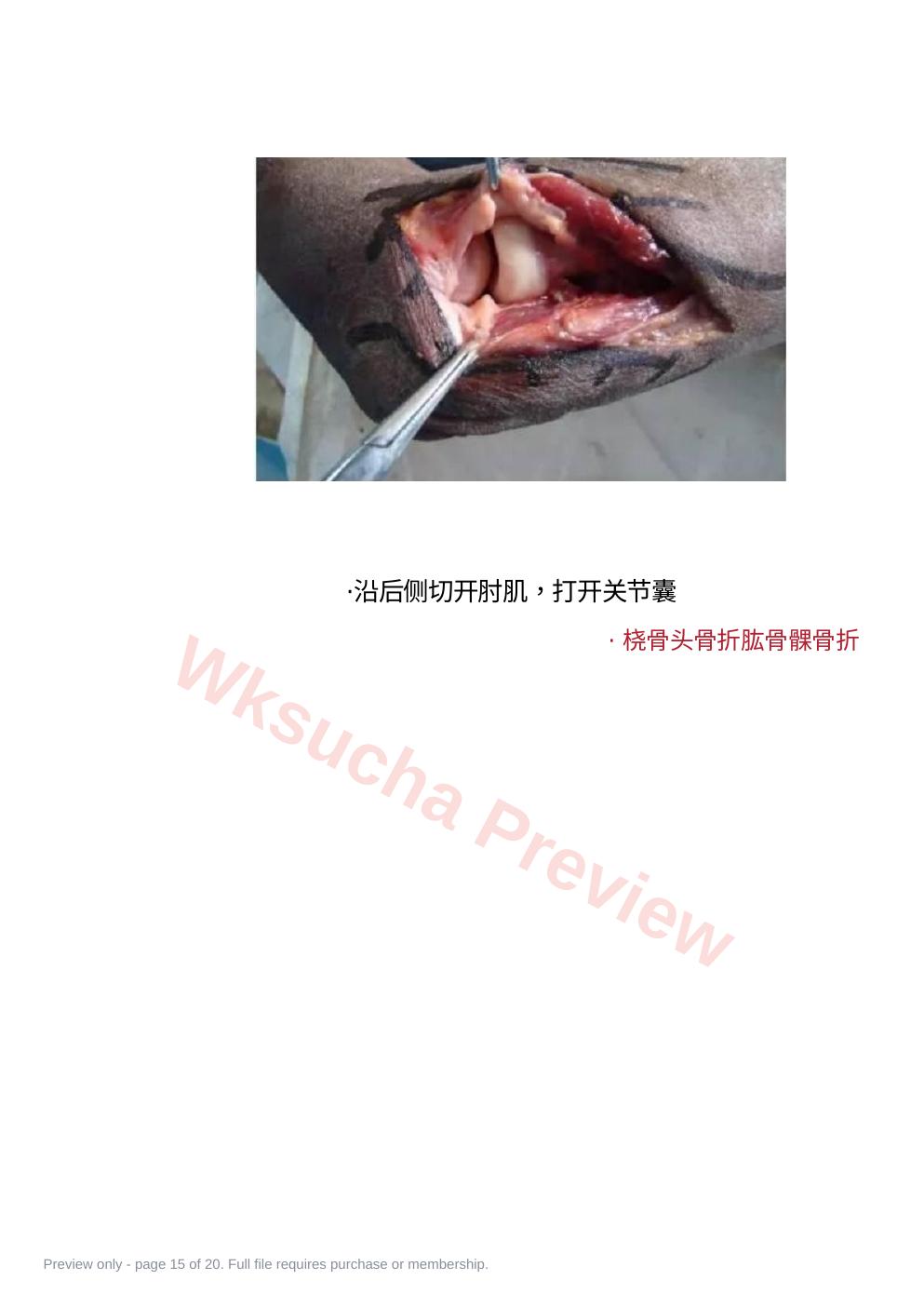 预览第 15 页