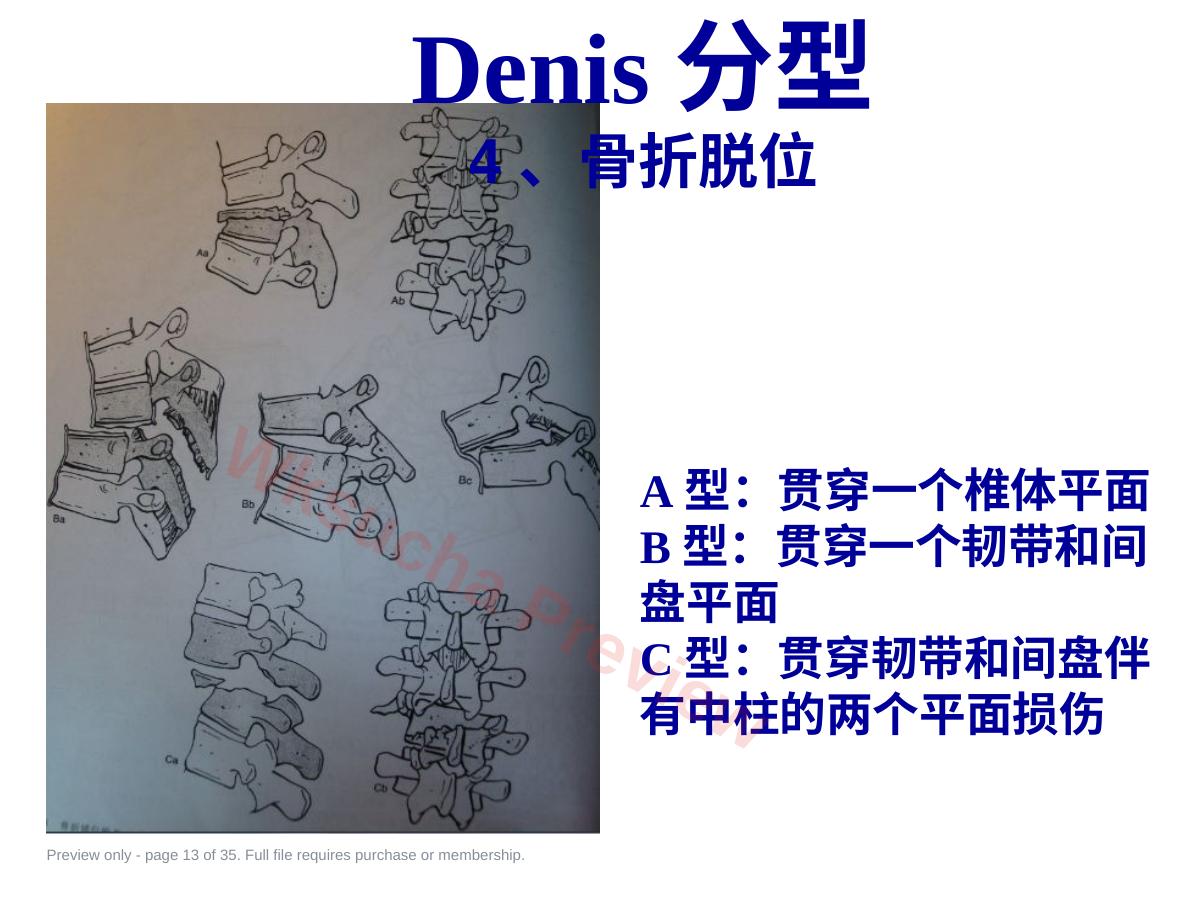 预览第 13 页