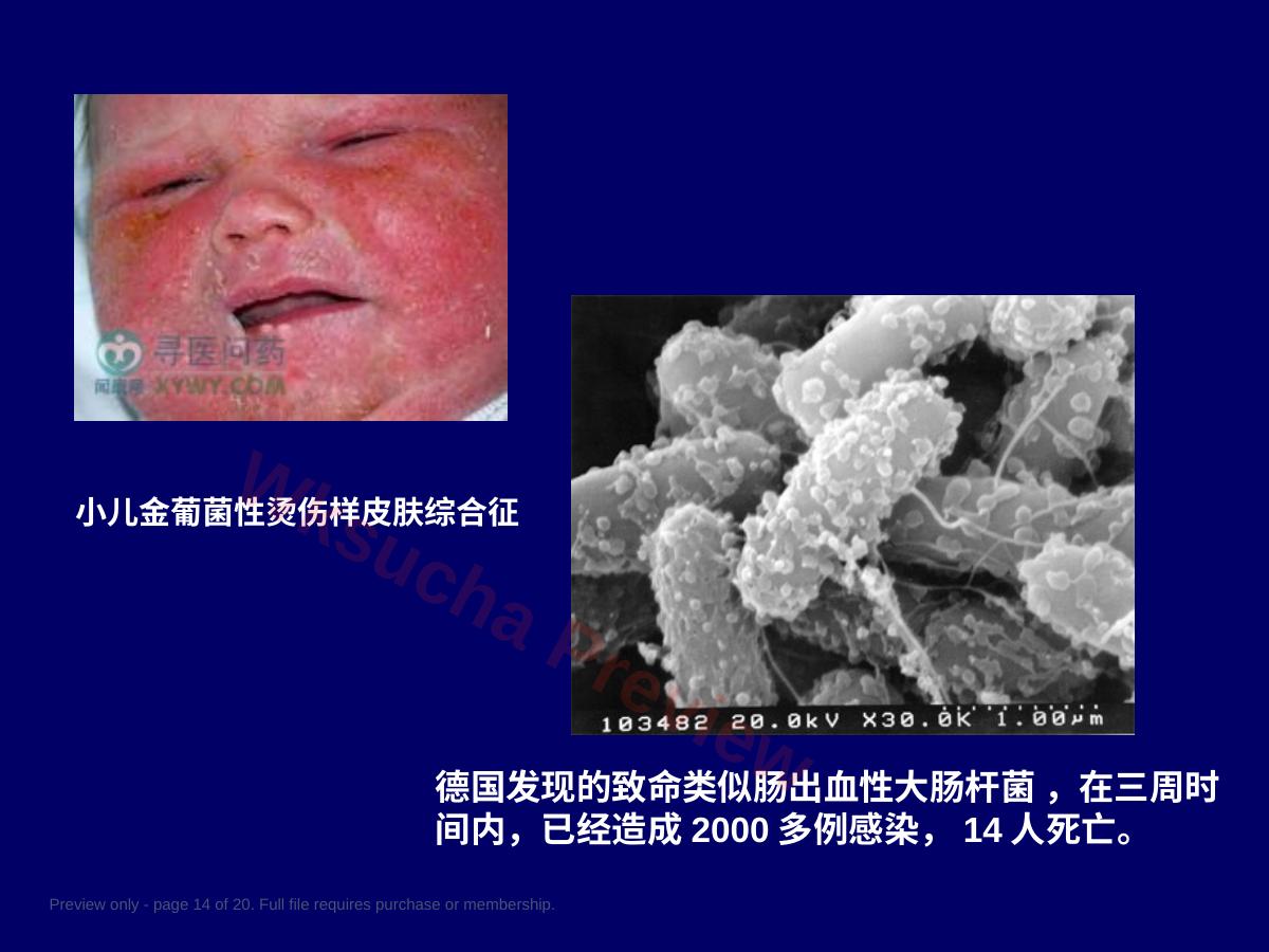 预览第 14 页