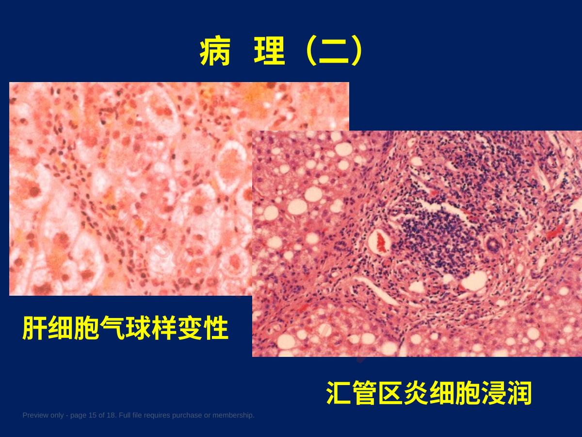 预览第 15 页