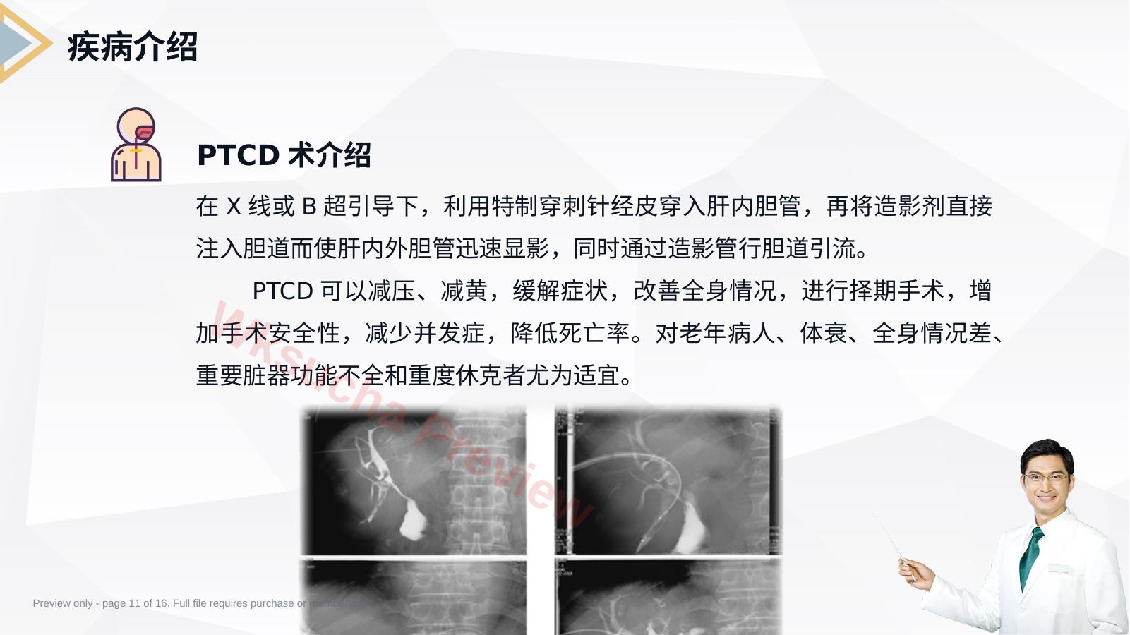 预览第 11 页