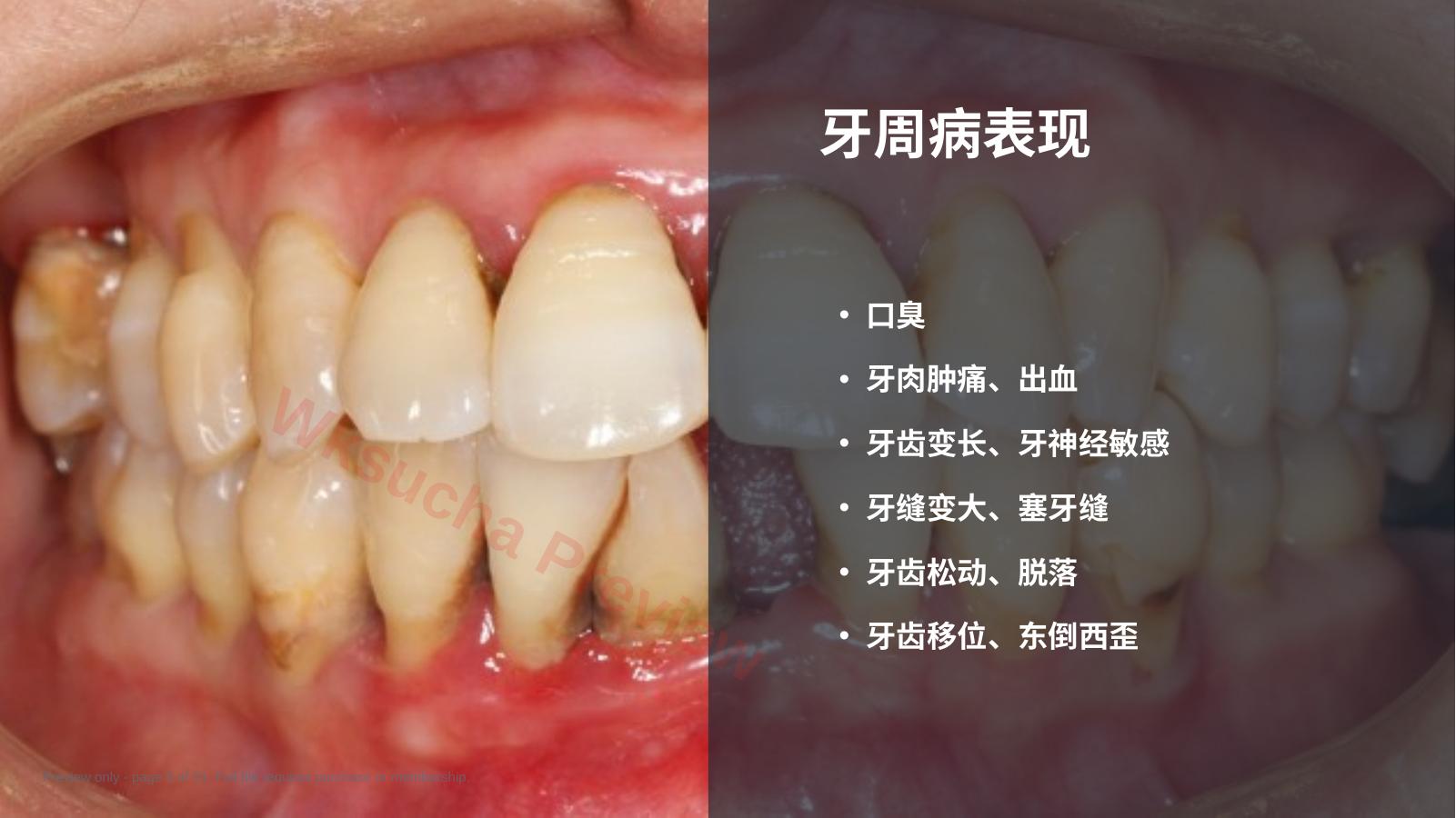 预览第 5 页