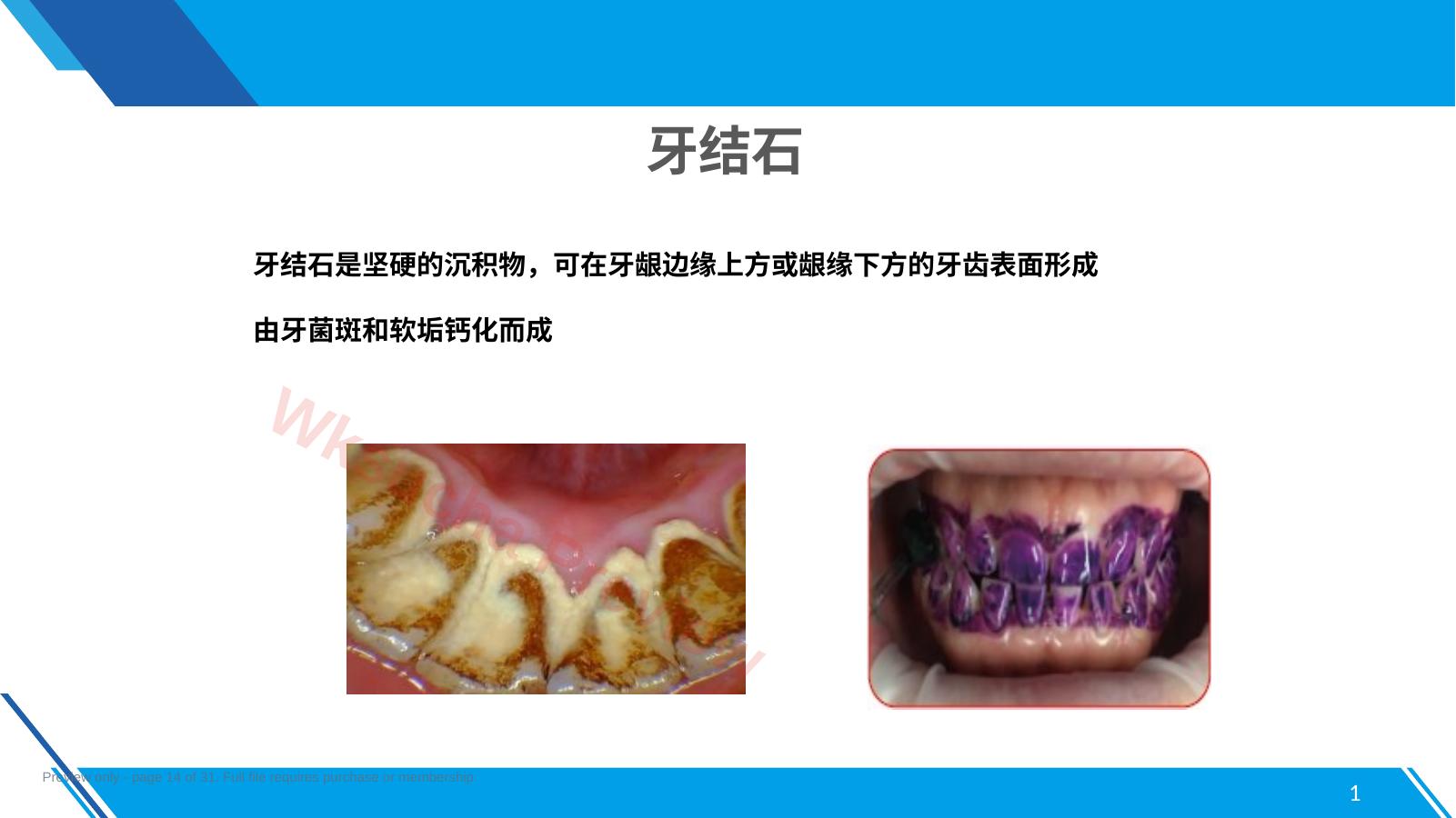 预览第 14 页