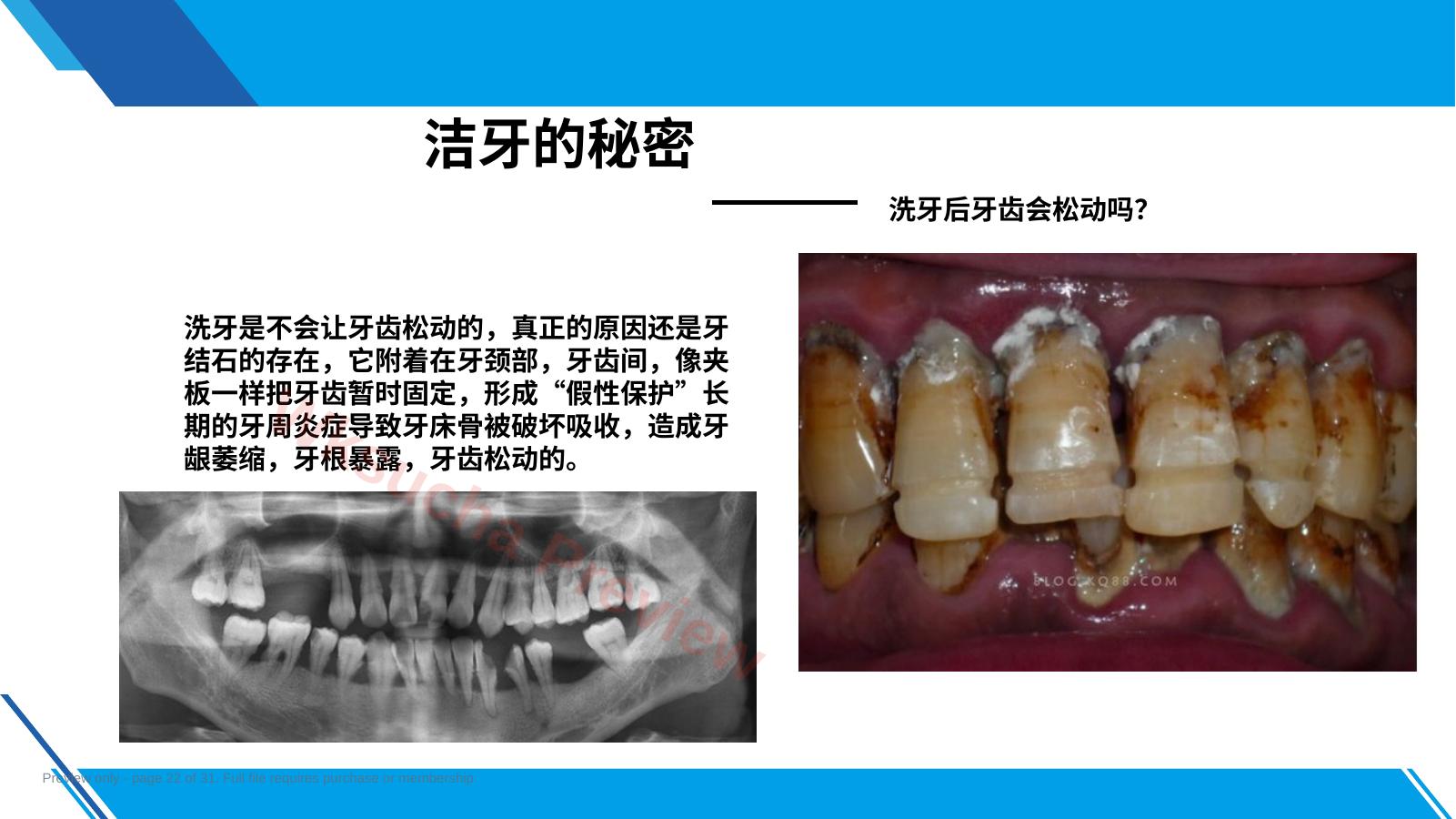 预览第 22 页