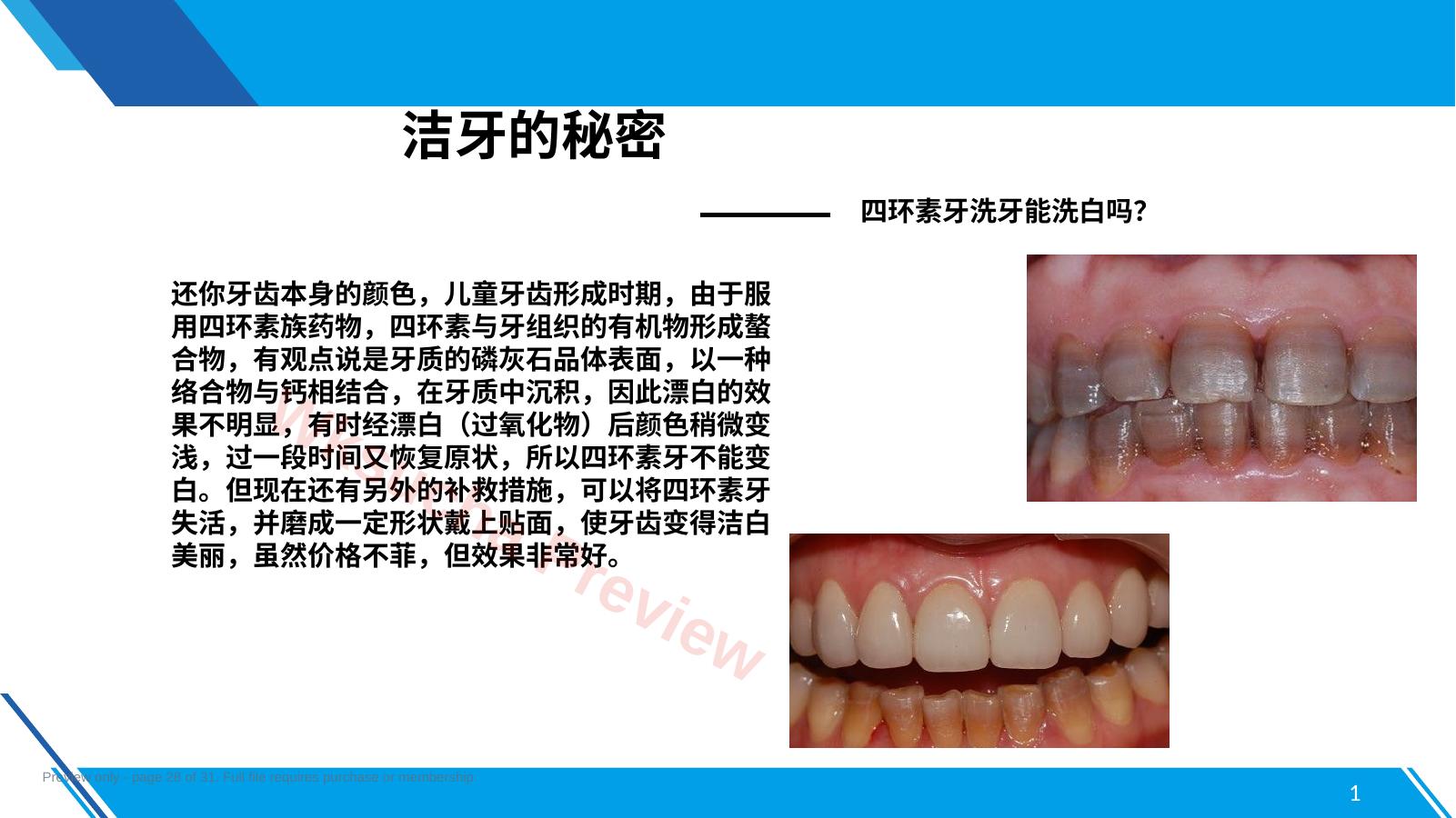 预览第 28 页
