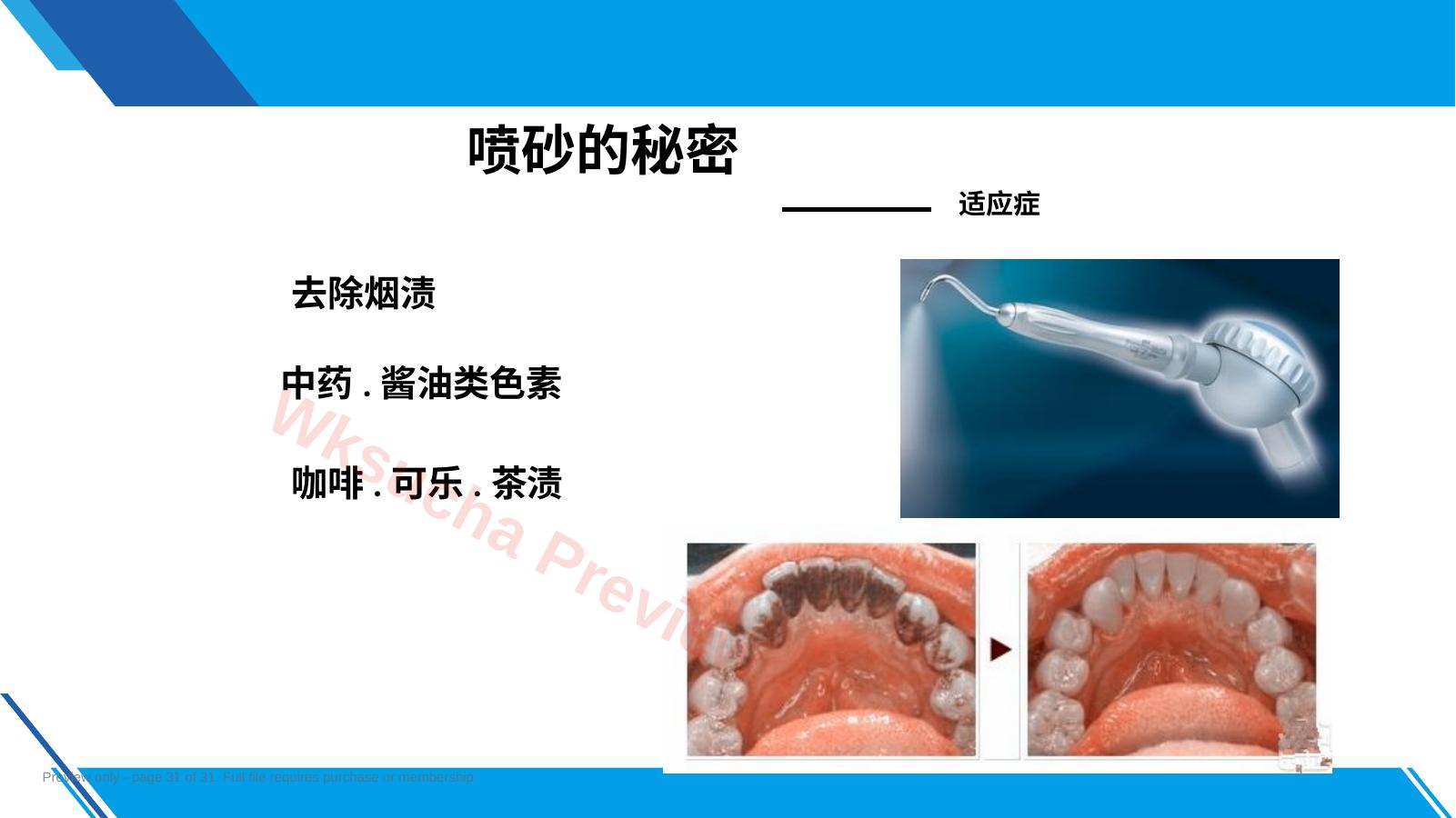 预览第 31 页