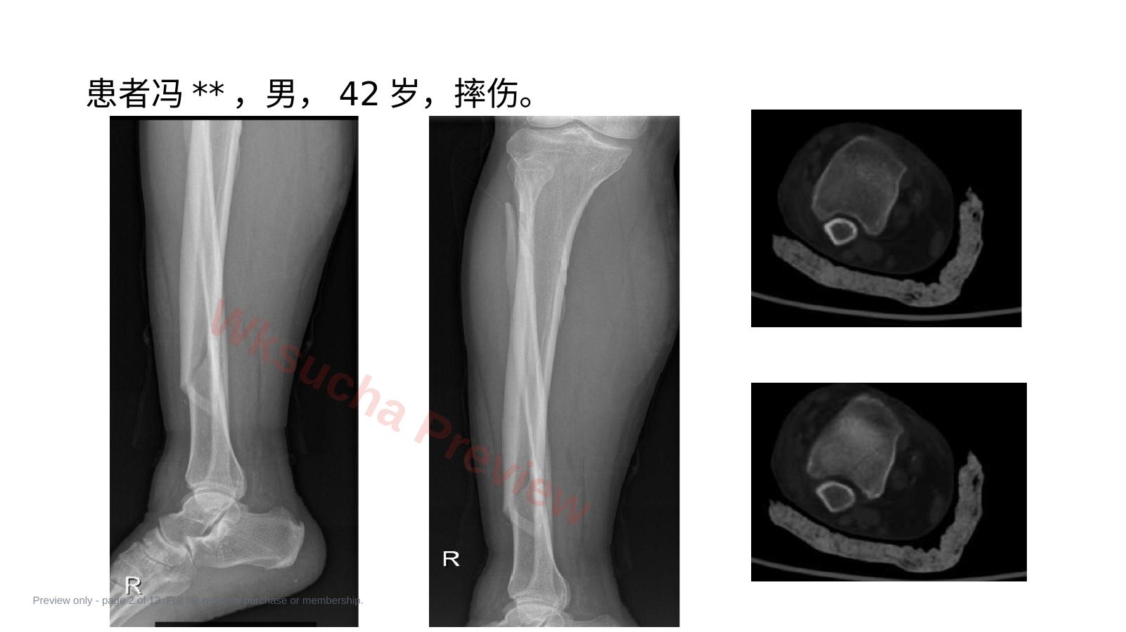 预览第 2 页
