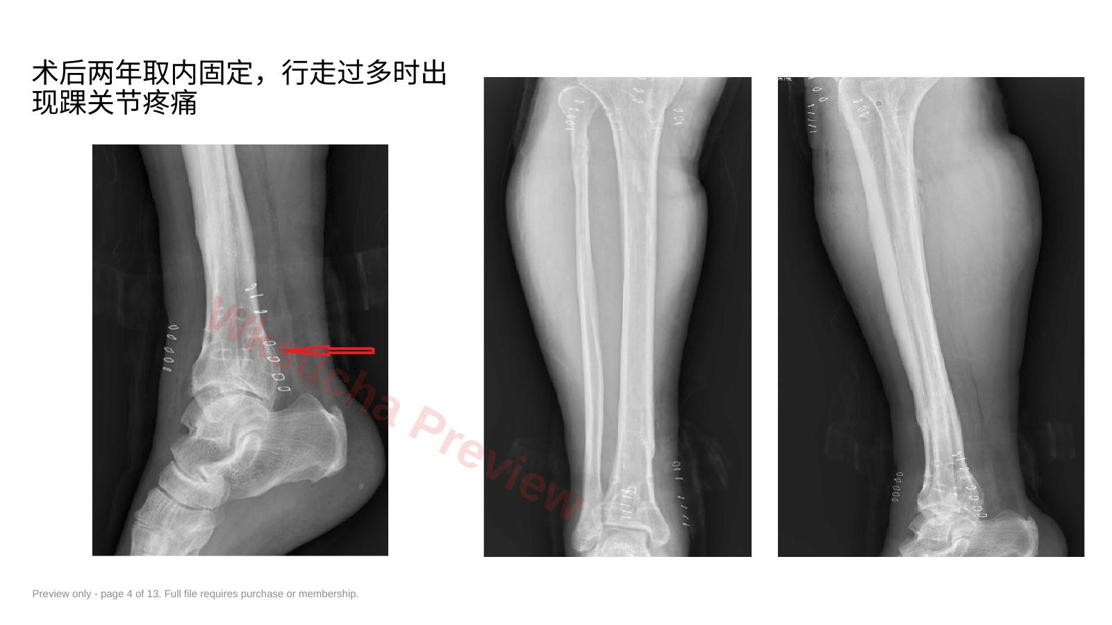 预览第 4 页