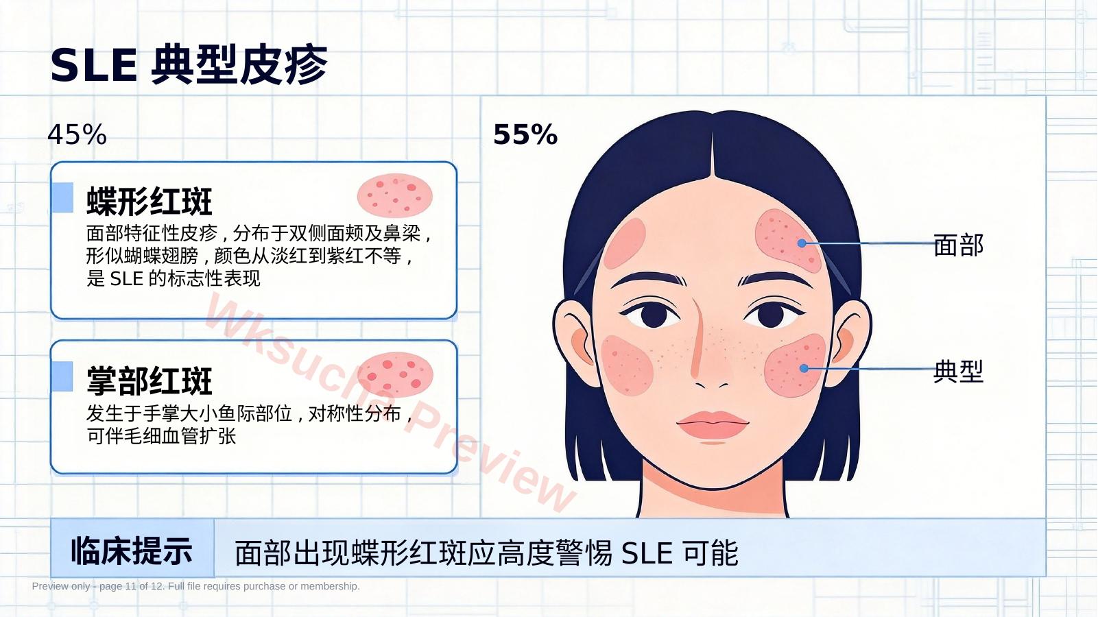 预览第 11 页