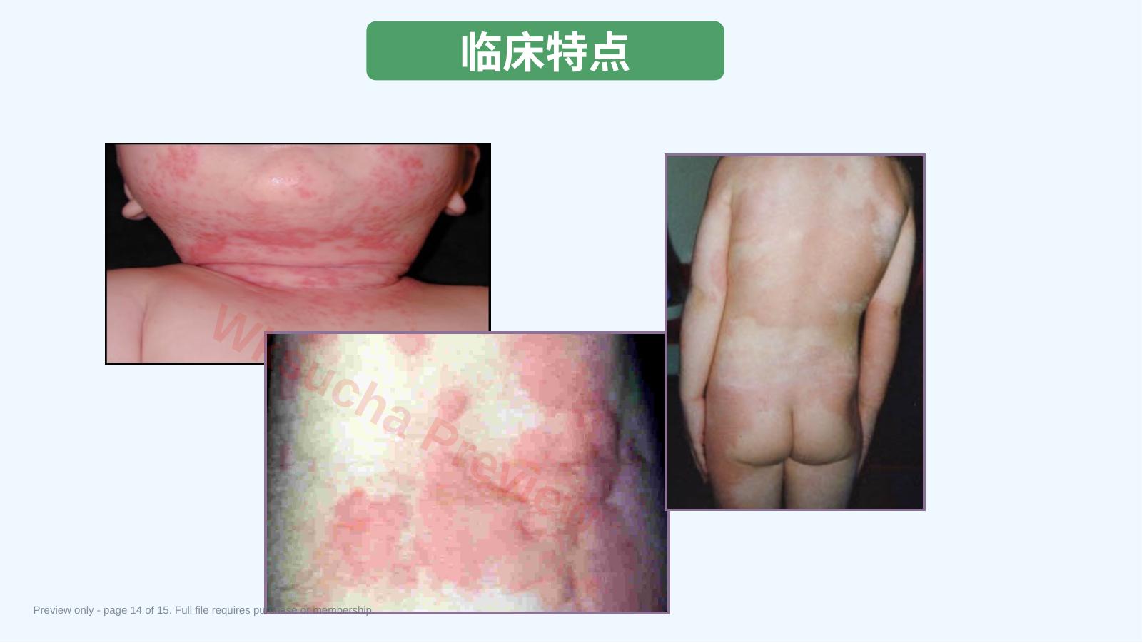预览第 14 页
