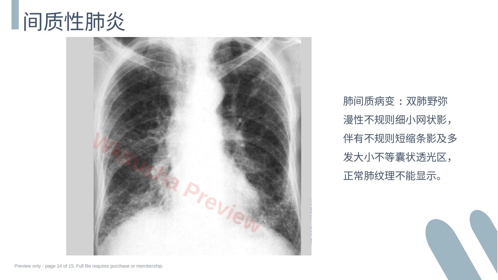 预览第 14 页