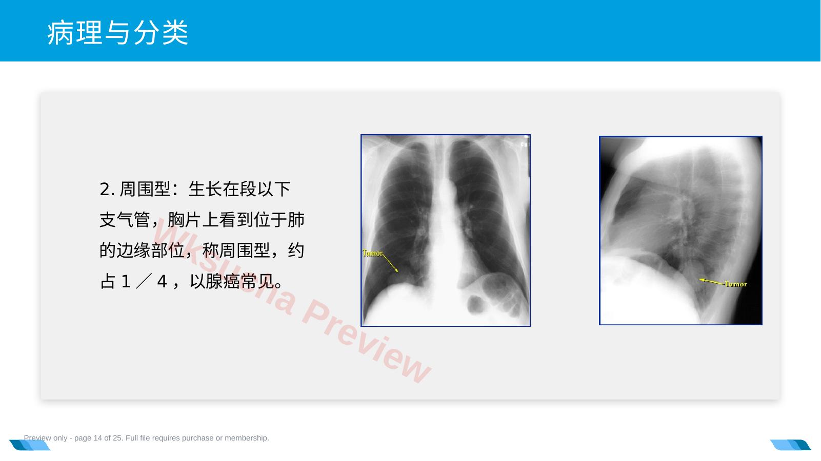 预览第 14 页