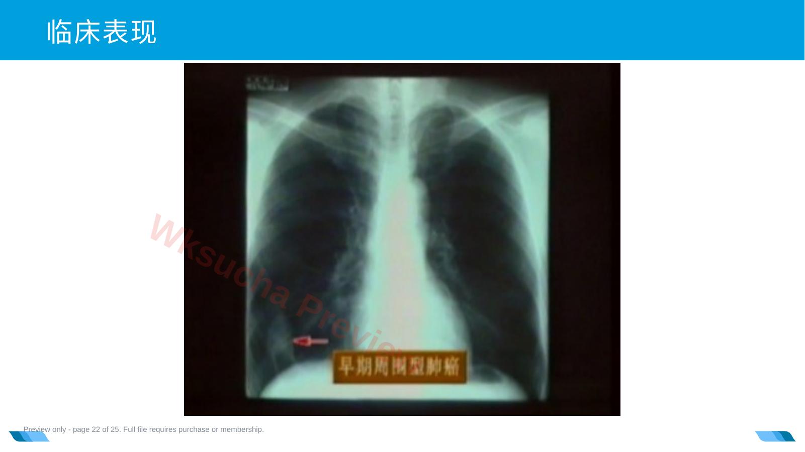 预览第 22 页