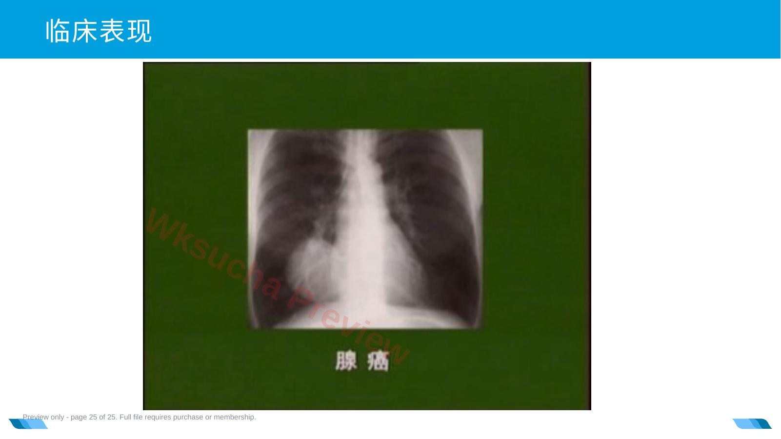 预览第 25 页