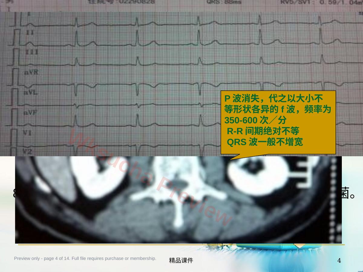 预览第 4 页