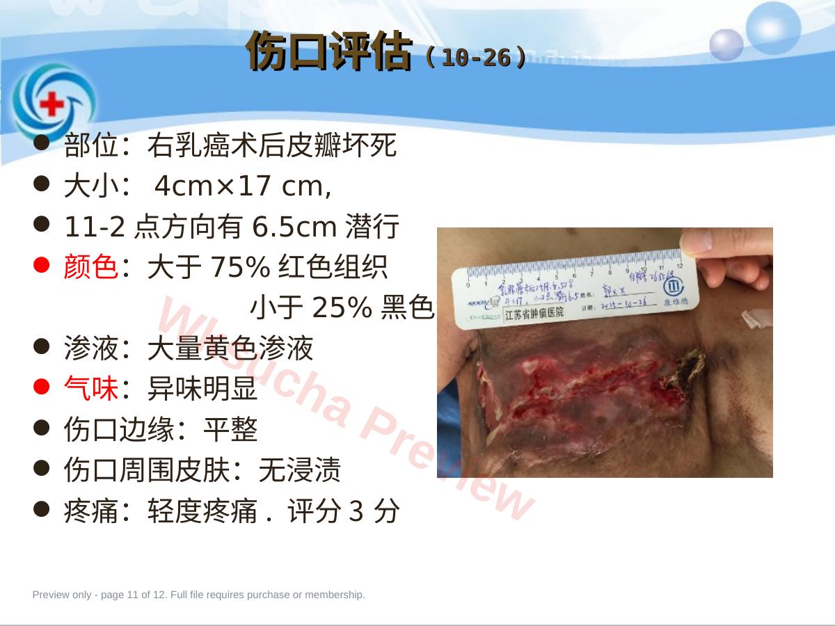 预览第 11 页