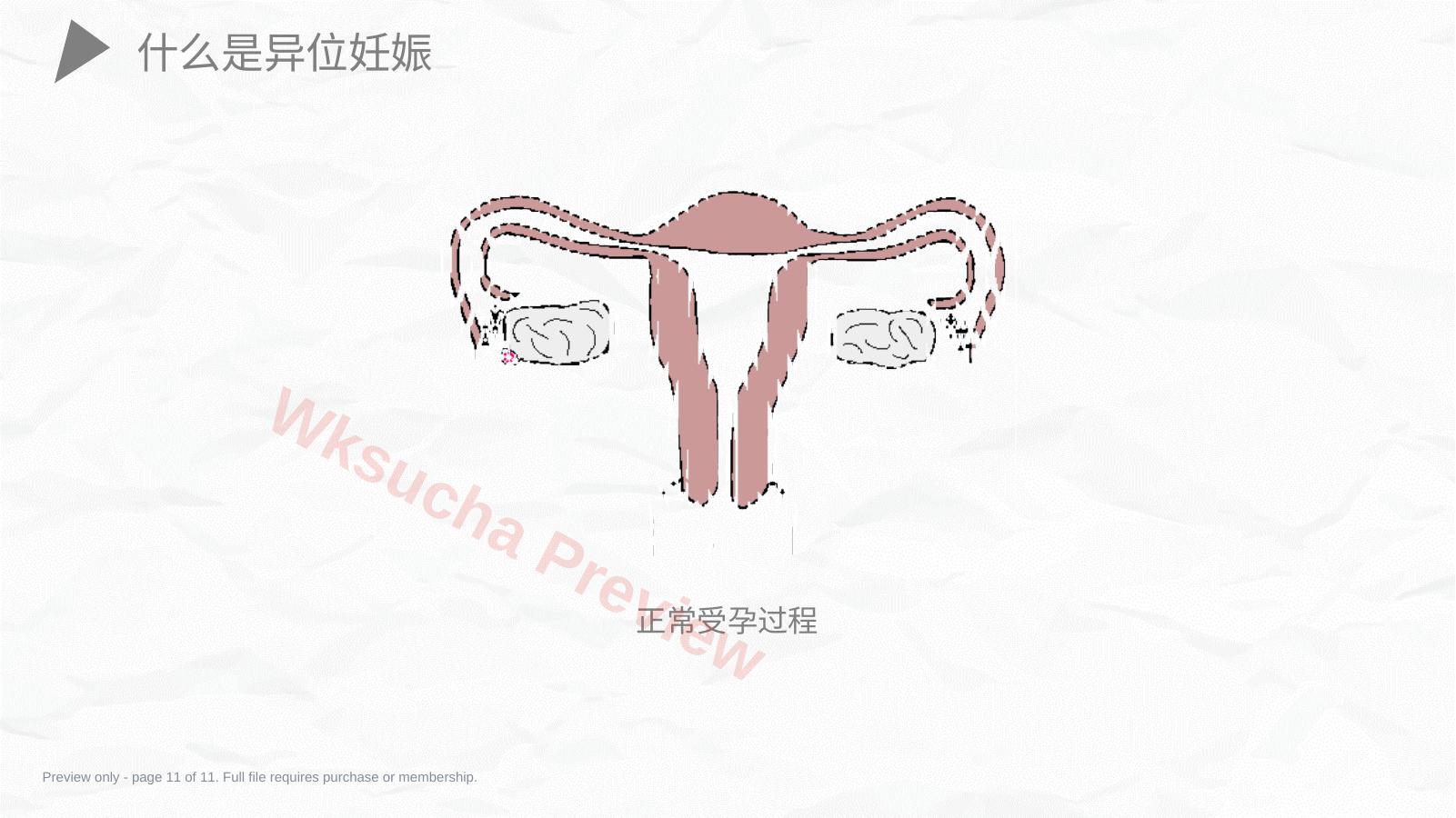 预览第 11 页