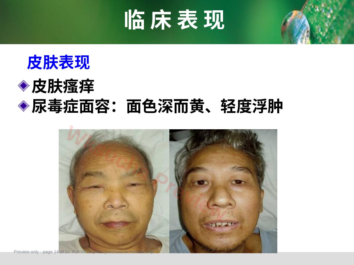 预览第 14 页