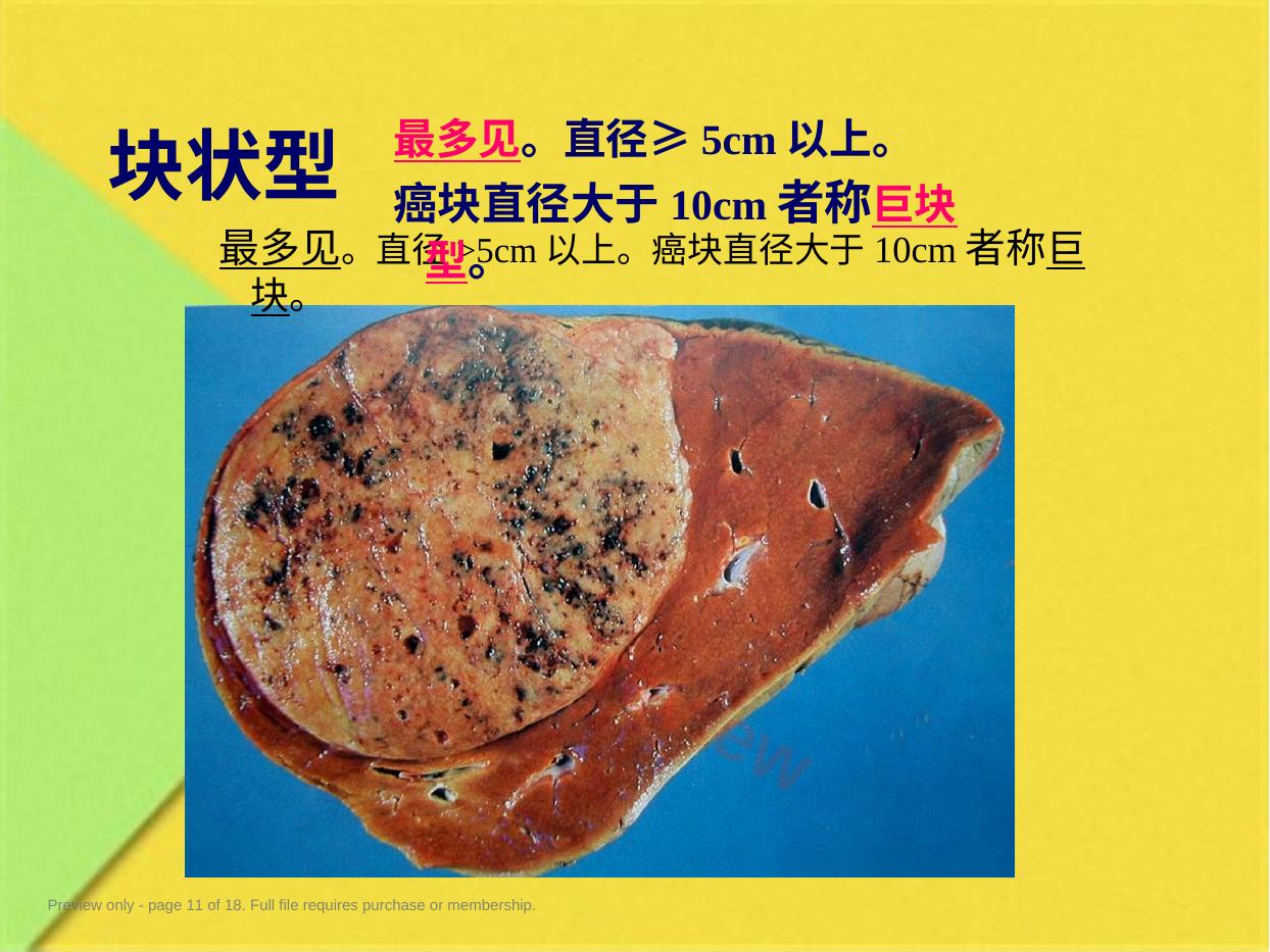 预览第 11 页