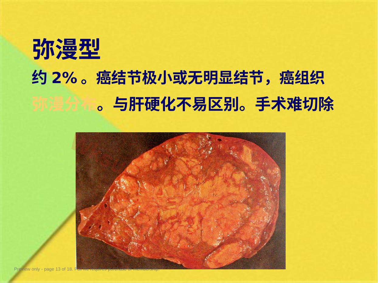 预览第 13 页