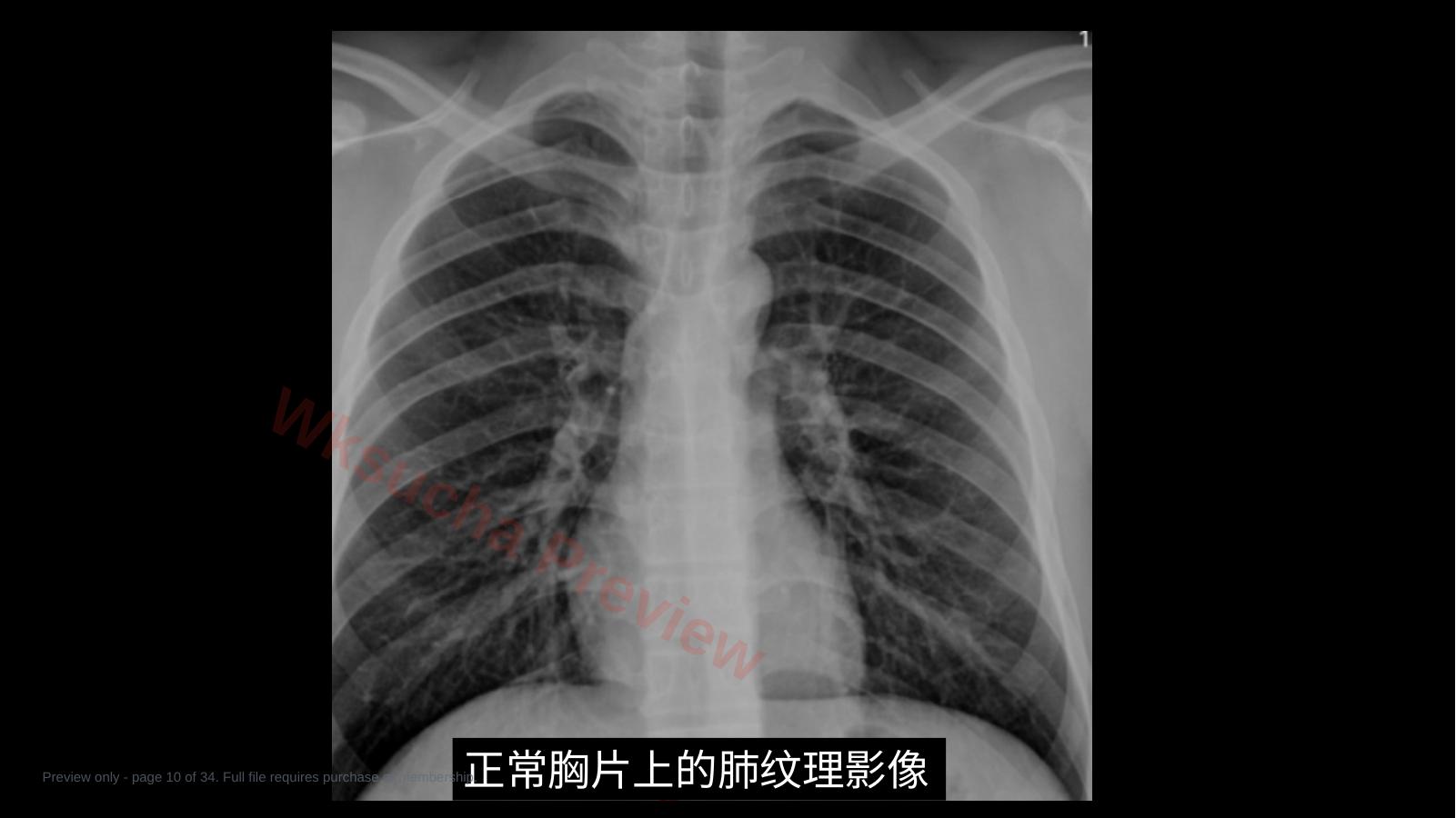 预览第 10 页