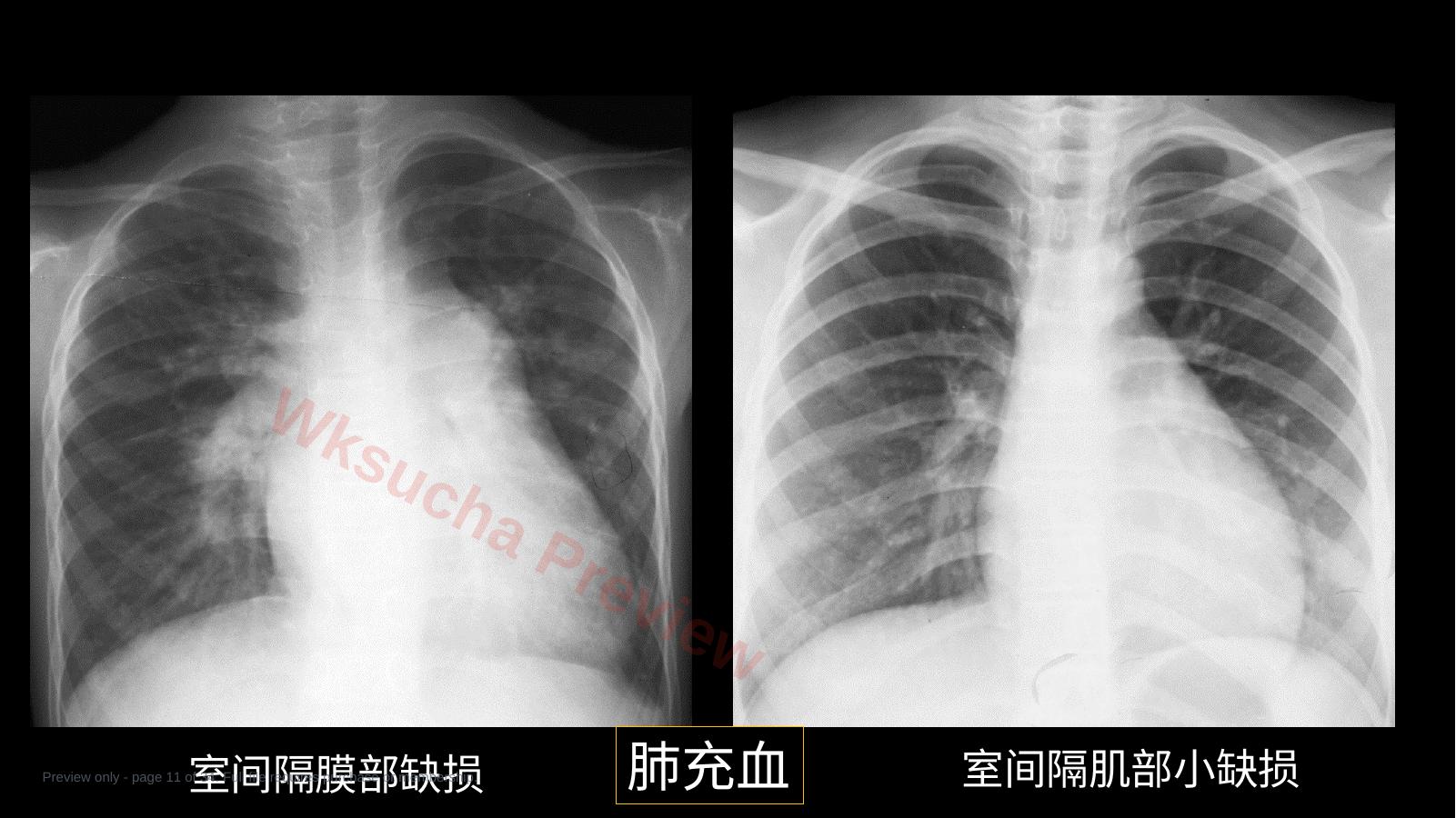 预览第 11 页