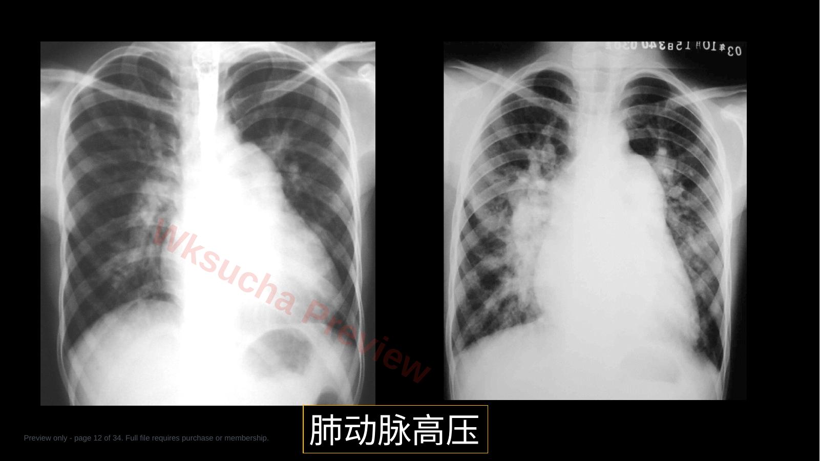 预览第 12 页
